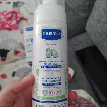 Mustela'nın Ürünleri Oğlumda Kabartı Ve Kızarıklık Yaptı!