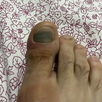 ÇiçekSepeti Koray Spor İade Ve Değişim Yapmıyor