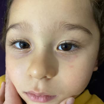 Mardin Afacanlar Dünyası Hem İlgisiz Hem De Hijyen Değil