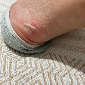 Pelin'in Ayakkabıları P. Ayakkabıları Ürününün Arkasında Durmuyor