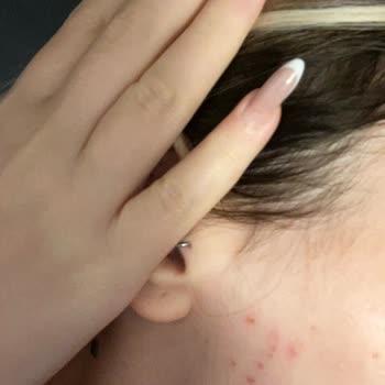 Vivet Tüğ Sarartıcı Krem Mağduru