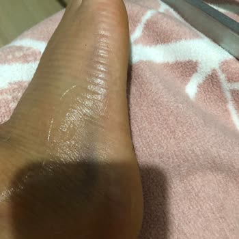 Puma Ayakkabı Mahvetti Ayaklarımı