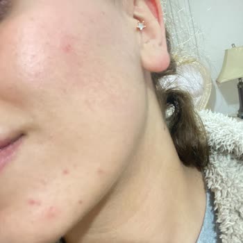 Elin Güzellik Bayraklı Cilt Bakımı Cilt Nasıl Mahvedilir