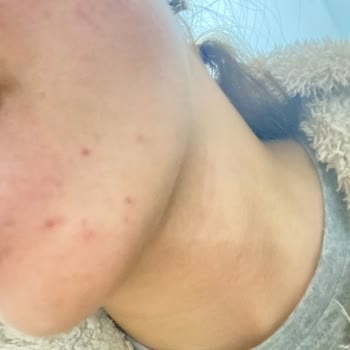 Elin Güzellik Bayraklı Cilt Bakımı Cilt Nasıl Mahvedilir