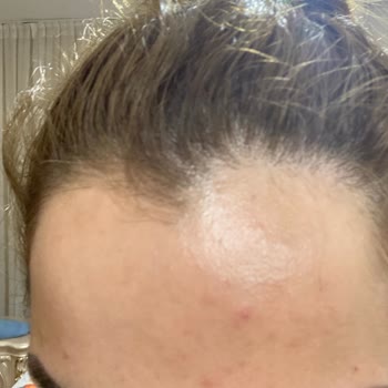 Elin Güzellik Bayraklı Cilt Bakımı Cilt Nasıl Mahvedilir