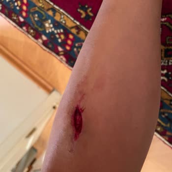 Başkent Üniversitesi İzmir Hastanesi İşinizi Sevmiyorsanız, Bu İşi Yapmayın