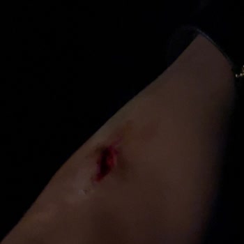 Başkent Üniversitesi İzmir Hastanesi İşinizi Sevmiyorsanız, Bu İşi Yapmayın