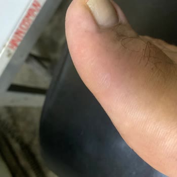 Mekap İş Güvenlik Ayakkabılarının Kullanım Şikayetleri