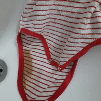 Molfixs İle Sızan Bez Keyifsiz Bebekler Huzursuz Anneler