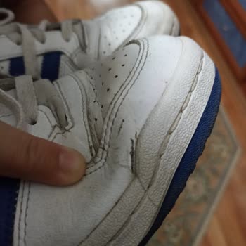 Adidas Forum Low 1 Yıl İçinde Geldiği Durum