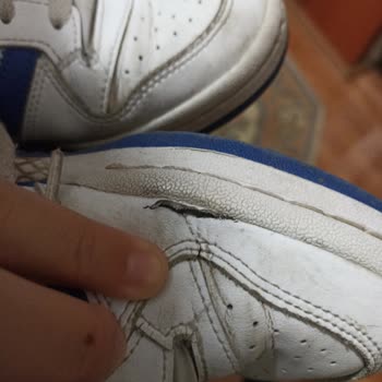 Adidas Forum Low 1 Yıl İçinde Geldiği Durum