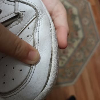 Adidas Forum Low 1 Yıl İçinde Geldiği Durum