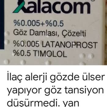 Sağlık Bakanlığı Göz Tansiyonu İlaçlarının Yan Etkileri