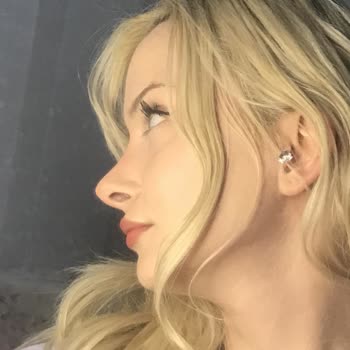 British Esthetic İstediğim Burunu Yapmadı Eksik Bilgilendirdi Ve Ücretsiz Düzeltmediler