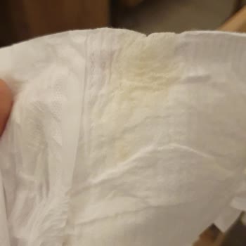 Molfix Paket İçerisinde Yapışkan Madde Bulunan Bebek Bezi Şikayeti