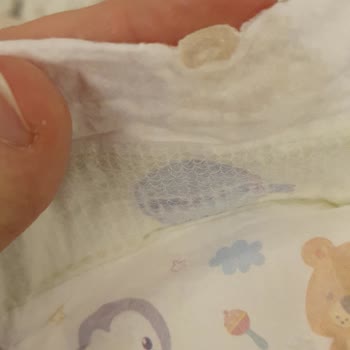 Molfix Paket İçerisinde Yapışkan Madde Bulunan Bebek Bezi Şikayeti