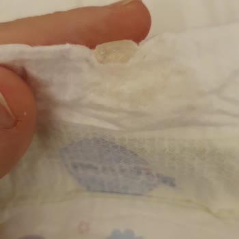 Molfix Paket İçerisinde Yapışkan Madde Bulunan Bebek Bezi Şikayeti