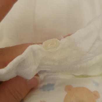 Molfix Paket İçerisinde Yapışkan Madde Bulunan Bebek Bezi Şikayeti