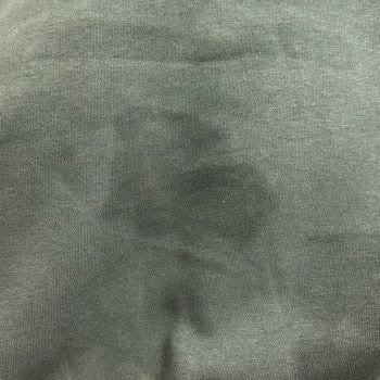 Yıldız Forma Hoodie Siparişimde Yaşanan Sorunlar