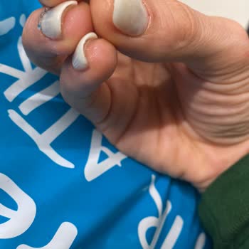 Fitaş Watsons Protez Tırnak Mağduriyeti
