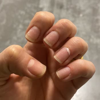 Fitaş Watsons Protez Tırnak Mağduriyeti