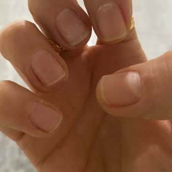 Fitaş Watsons Protez Tırnak Mağduriyeti