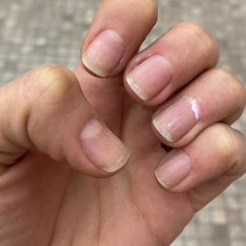 Fitaş Watsons Protez Tırnak Mağduriyeti