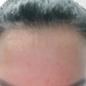 Nivea Egzama Olma Garantili