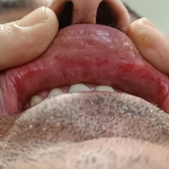 Damaklarıma Zarar Veren Colgate!