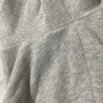 Antalya Migros Avm Ürün Tüylenmesine Saygısız Tepki!