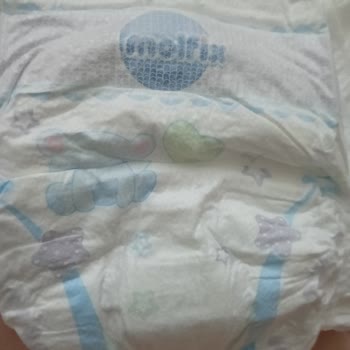 Molfix Kalitesi Mi Düştü Yoksa Sahtemi