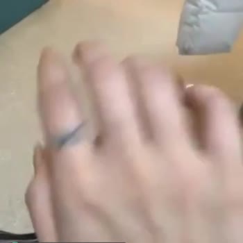 Akdeniz Üniversitesi Hastanesi Korkunç Hastane Parmağım Çıkık 5 Saattir Bekliyorum
