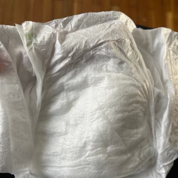 Baby Turco4 Numaralı Bez Sorunu