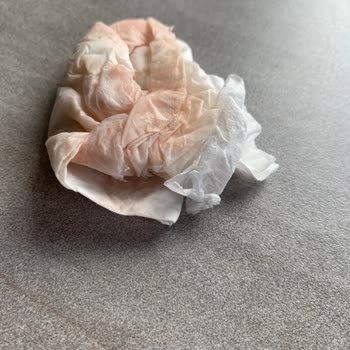 Liva Pastanesi (livashop.com) Livanın Her Zaman Ki Hijyensiz Ortamı