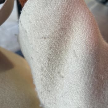 Pull And Bear Luxury Koleksiyon Kabanın Kalitesizliği