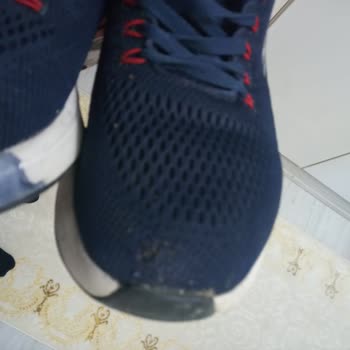 Skechers Spor Ayakkabı Kalitesi Ve Müşteri Memnuniyetsizliği