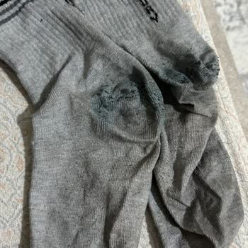 Siirt Park AVM Ayakkabı Satın Alma Sonrası Yaşanan Sorunlar Ve Müşteri Hizmetleri Şikayeti