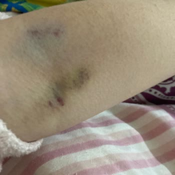 Kolan Hospital Personel Şikayeti Hk.