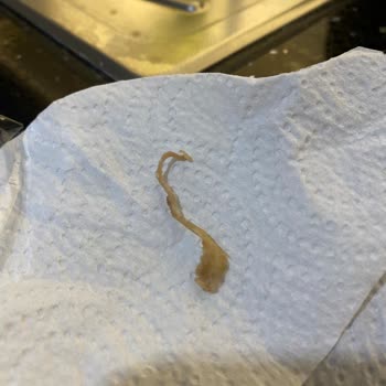 A101 Kalitesiz Köfte Hayal Kırıklığı Yarattı