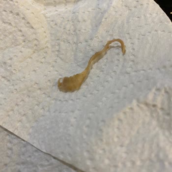 A101 Kalitesiz Köfte Hayal Kırıklığı Yarattı