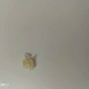 BİM Efsane Kırık Pirinçten Kötü Koku Gelmesi Ve İçinden Yapışkan Çıkması