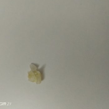 BİM Efsane Kırık Pirinçten Kötü Koku Gelmesi Ve İçinden Yapışkan Çıkması