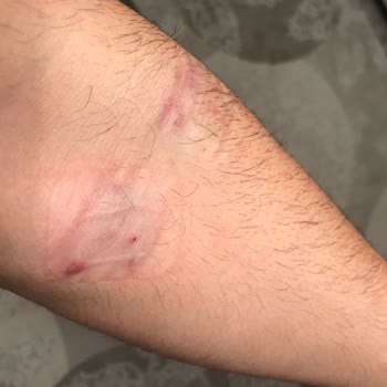 Türk Kızılay'a Kan Vermenin Sonucu