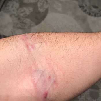 Türk Kızılay'a Kan Vermenin Sonucu