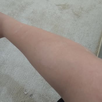 Agiss Tüy Dökücü Köpük Cildime Zarar Verdi!