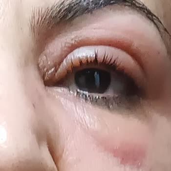 Loreal Paris Balon Gibi Şişirdi