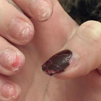 Bolu Angelique Güzellik Son Derece Hayal Kırıklığı Oldu!