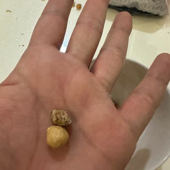 BİM Simbat Karışık Çerezde Taş Çıktı Ve Dişim Kırıldı.