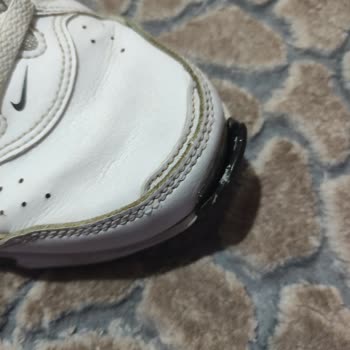 Ayakkabının Önü Açılması Ve Deichmann 6 Ay Garanti Süresi