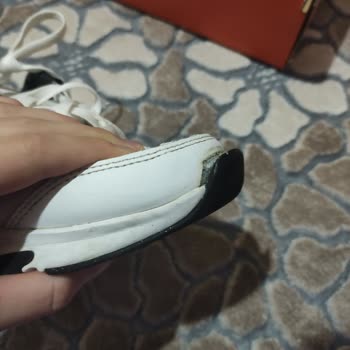Ayakkabının Önü Açılması Ve Deichmann 6 Ay Garanti Süresi